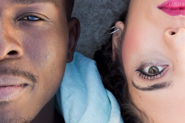 The Fascinating Truth About Heterochromia: What Different-Colored Eyes Reveal About You Heterochromia